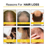 Infographic showing common reasons for hair loss: seborrheic scalp, genetic thinning, balding, postpartum loss, dry hair damage, and stress