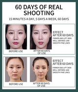 2024 Smart Facial Massager Lifting and Firming V-shaped Face-lifting Device All-round Body Shaping Anti-aging Beauty Instrument