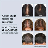 180LEDS 660NM&850NM Hair Regrowth Cap Reduces Oiliness Deep Into Hair Follicles Strengthen Hair Roots Relieves Fatigue Hat