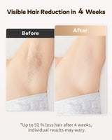 Visible IPL Hair Removal Results on Underarms After 4 Weeks