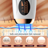 IPL laser beam penetrating skin to stop hair growth – 4-week hair removal cycle illustration