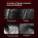 Before and after scalp close-ups showing cleaner part line and denser-looking hair after scalp care