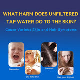 Effects of Unfiltered Tap Water β Dry Skin, Dandruff, Hair Loss