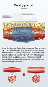 Illustration of high-intensity focused electromagnetic technology used in EMS body sculpting machine.