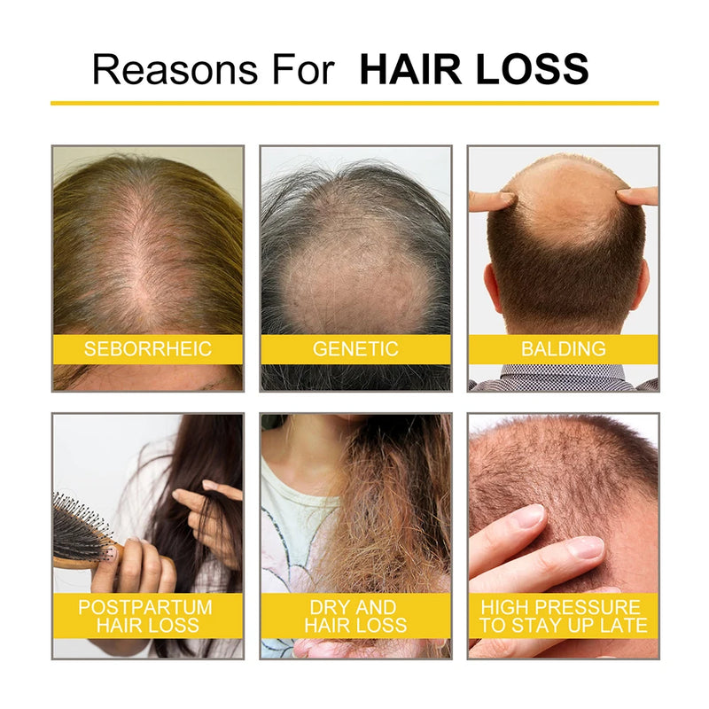 Infographic showing common reasons for hair loss: seborrheic scalp, genetic thinning, balding, postpartum loss, dry hair damage, and stress