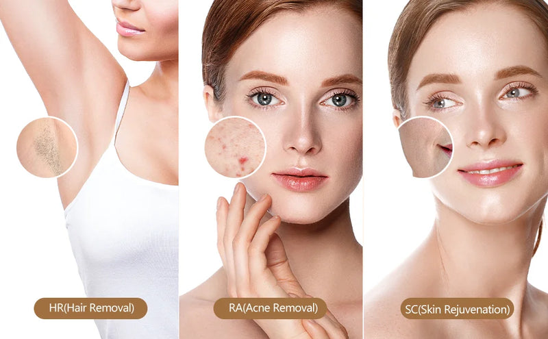 IPL Epilator 999000 Flashes Laser Hair Removal Painless Permanent Photoepilation for Men Women Trimmer Electric Depilador