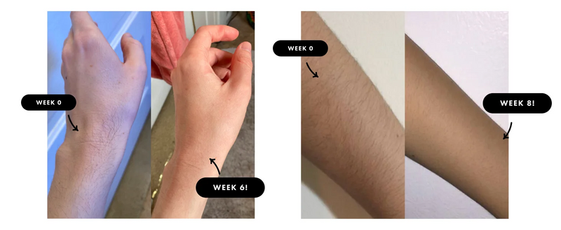 IPL Hair Removal Unlimited Flashes 9 Gears Laser Ice-Cooling Painless Electric Depilator For Men Women Body Bikinis intimate