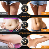 Before and after comparison of thigh, abdomen, and arm showing firmer-looking skin with RF sessions