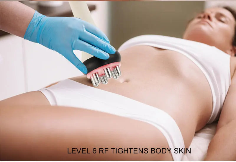 RF body probe used on the abdomen to help firm the appearance of skin